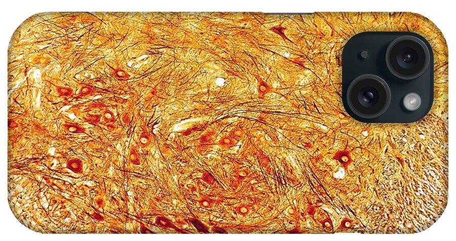 Cajal iPhone Case featuring the photograph Motor Neurons In Spinal Cord #1 by Jose Calvo / Science Photo Library