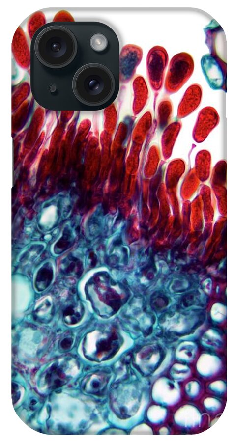 Light Micrograph iPhone Case featuring the photograph Rust Fungus In A Leaf #1 by Dr Keith Wheeler/science Photo Library