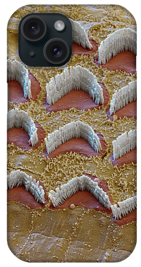 Cochlea iPhone Case featuring the photograph Cochlea, Outer Hair Cells, Sem #8 by Oliver Meckes EYE OF SCIENCE