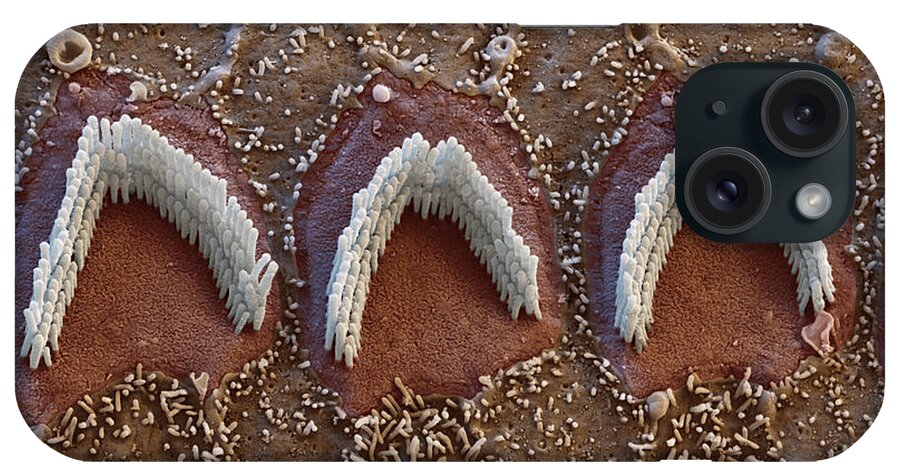 Cochlea iPhone Case featuring the photograph Cochlea, Outer Hair Cells, Sem #9 by Oliver Meckes EYE OF SCIENCE