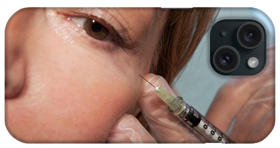 Medical iPhone Case featuring the photograph Botox Injection by Pascal Goetgheluck/science Photo Library