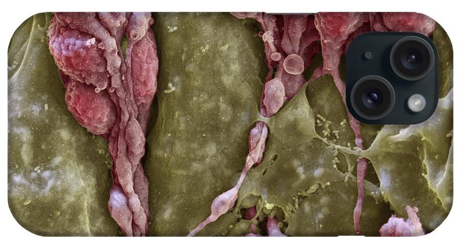 Cochlea iPhone Case featuring the photograph Cochlea, Nerve Fibers, Sem by Oliver Meckes EYE OF SCIENCE