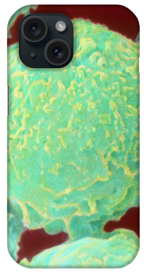 Round Shape iPhone Case featuring the photograph Coloured Sem Of White Blood Cells (neutrophils) by Dr Kari Lounatmaa/science Photo Library