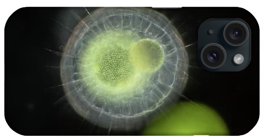 Amoeboid iPhone Case featuring the photograph Heliozoa Feeding On Volvox by Frank Fox/science Photo Library