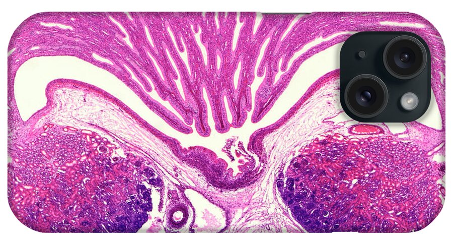 Anatomical iPhone Case featuring the photograph Tissue From A Cat's Kidney by Nigel Downer/science Photo Library