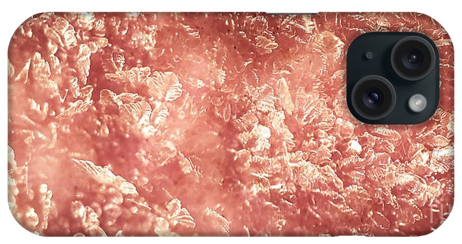 Frost iPhone Case featuring the photograph Pink Ice by Robert Knight