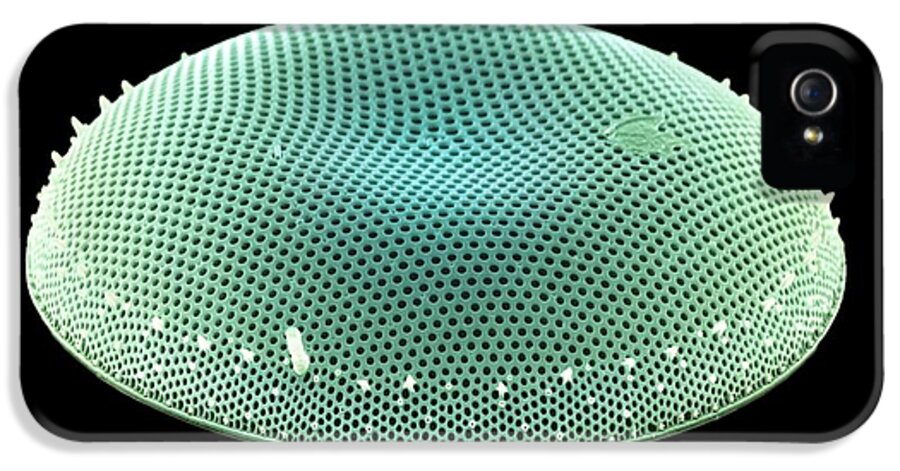 Diatom iPhone 5 Case featuring the photograph Diatom Alga, Sem #59 by Steve Gschmeissner