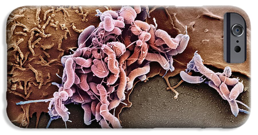Campylobacter Pyloridis iPhone 6 Case featuring the photograph Helicobacter Pylori Bacteria, Sem #1 by 