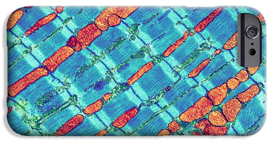 Mitochondrion iPhone 6 Case featuring the photograph Cardiac Muscle, Tem #7 by Thomas Deerinck, Ncmir