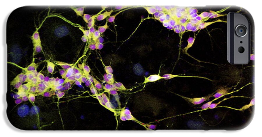 Cell iPhone 6 Case featuring the photograph Nerve Cell Growth #1 by Francois Paquet-durand