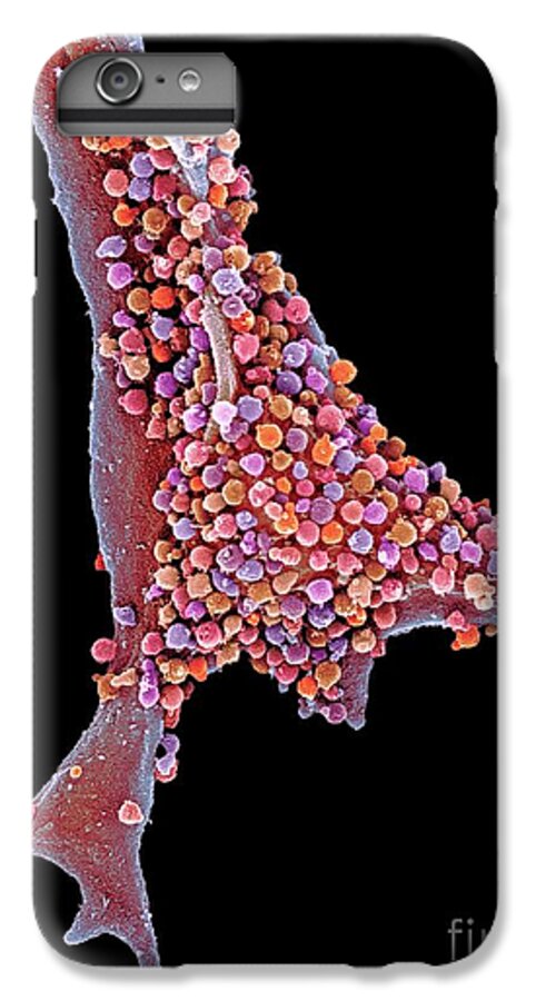 Cell Infected With Herpes Virus iPhone 6 Plus Case for Sale by Science  Photo Library