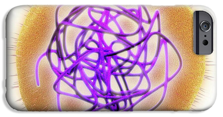 Infection iPhone 6s Case featuring the photograph Rubella (german Measles) Virus #5 by Alfred Pasieka
