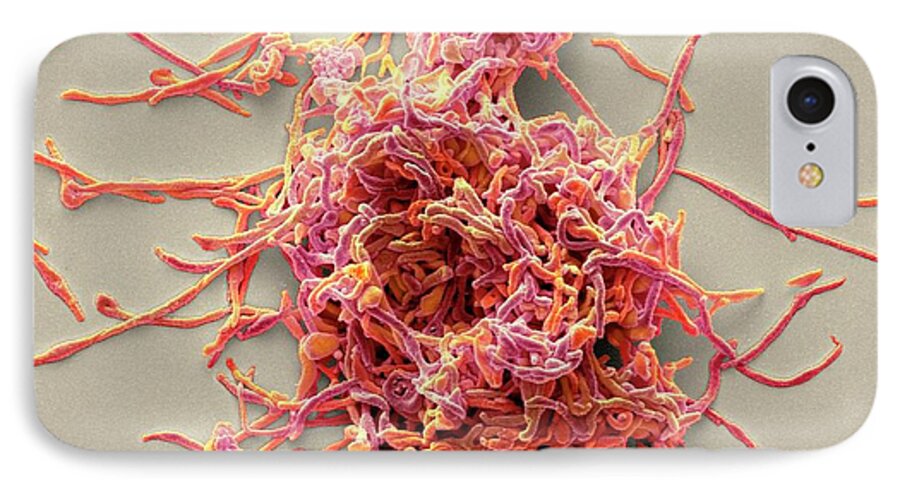 Bacteria iPhone 7 Case featuring the photograph Mycoplasma Pneumoniae #1 by Steve Gschmeissner