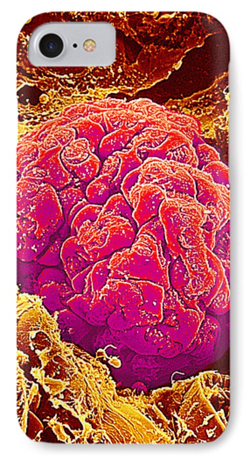 Magnified Image iPhone 7 Case featuring the photograph Kidney Glomerulus, Sem #3 by Susumu Nishinaga