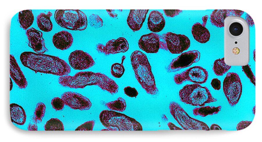 Microbiology iPhone 7 Case featuring the photograph Coxiella Burnetii Bacteria, Tem #4 by Science Source