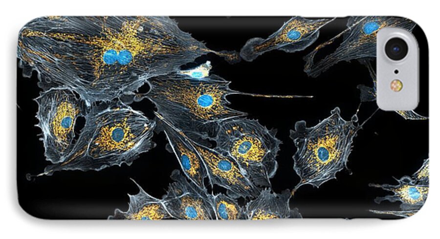 Biological iPhone 7 Case featuring the photograph Lung Cells, Fluorescent Micrograph #4 by Dr Torsten Wittmann
