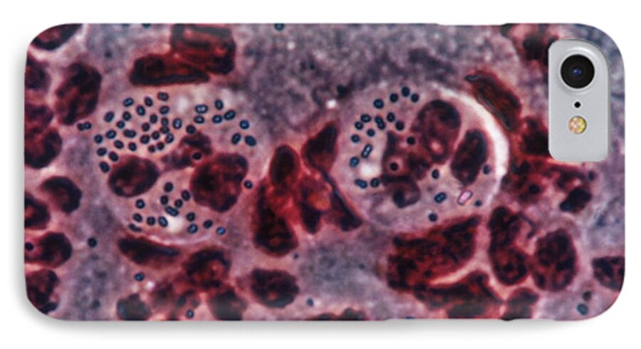 Science iPhone 7 Case featuring the photograph Neisseria Gonorrhea Lm by Eric V. Grave