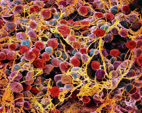 Magnified Image Poster featuring the photograph Coloured Sem Of Adipose Tissue Showing Fat Cells by Prof. P. Motta/dept. Of Anatomy/university \la Sapienza\, Rome/science Photo Library