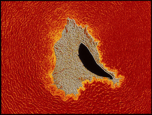 Magnified Image Poster featuring the photograph Atherosclerosis by Pasieka