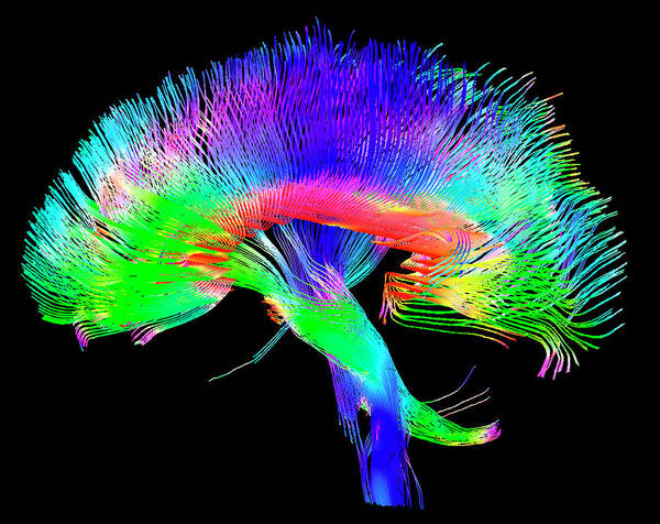 White Matter Poster featuring the photograph Brain Pathways by Tom Barrick, Chris Clark, Sghms