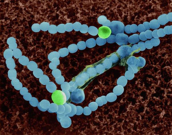 Nostocales Poster featuring the photograph Cyanobacterium (anabaena Sp.) by Dennis Kunkel Microscopy/science Photo Library