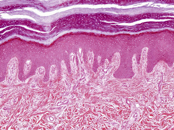 Skin Poster featuring the photograph Plantar Skin, Lm by Alvin Telser