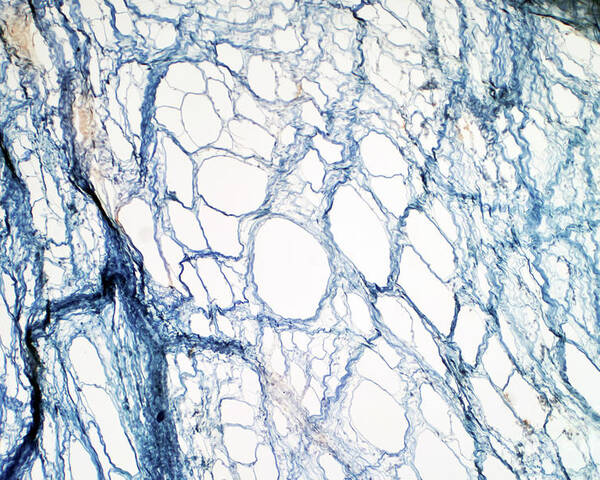 Tissue Poster featuring the photograph Areolar Connective Tissue by Choksawatdikorn / Science Photo Library
