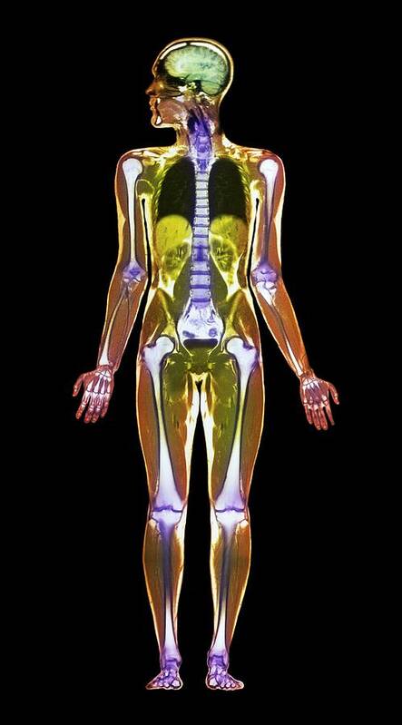 Whole Body Poster featuring the photograph Mri Body Scan by Simon Fraser/science Photo Library
