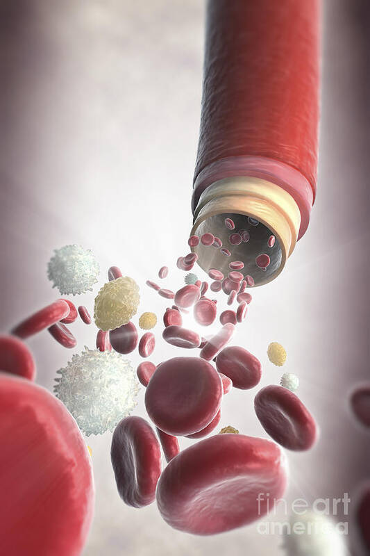 Blood Vessel Poster featuring the photograph Blood Vessel With Cells #8 by Science Picture Co