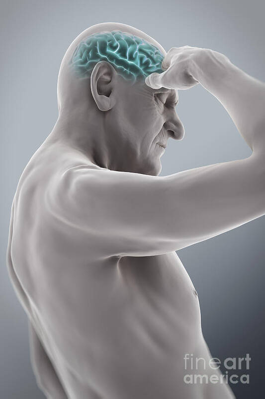 Head Pain Poster featuring the photograph Head Ache #5 by Science Picture Co