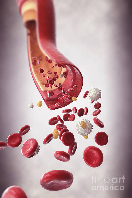 Blood Vessel Poster featuring the photograph Blood Vessel With Cells by Science Picture Co
