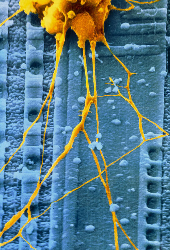 Nerve Cell Poster featuring the photograph Sem Of Human Nerve Cells by Synaptek