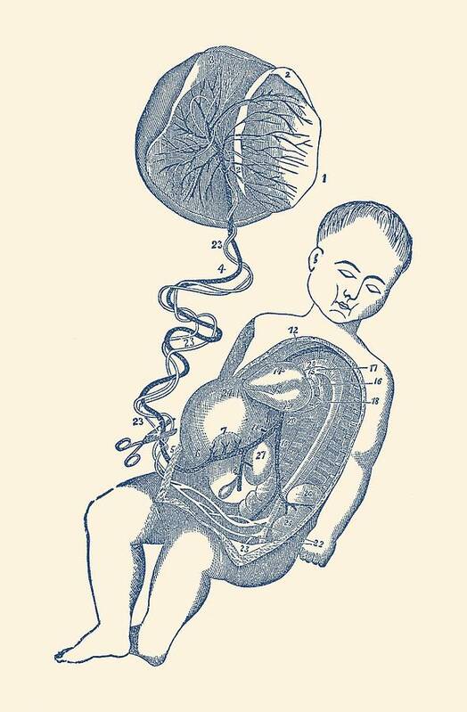 Fetal Circulatory System Poster featuring the drawing Baby and Placenta - Placenta Removal - Vintage Anatomy by Vintage Anatomy Prints
