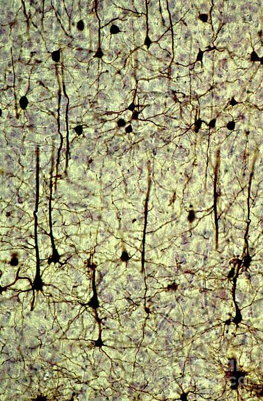 860204-24 Poster featuring the photograph Cerebral Cortex Pyramidal Neurons by Dennis Kunkel Microscopy/science Photo Library
