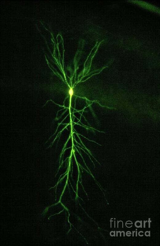 Brain Poster featuring the photograph Hippocampus Pyramidal Neuron by Dennis Kunkel Microscopy/science Photo Library