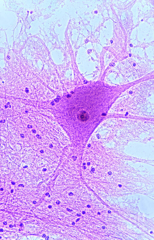 Histology Poster featuring the photograph Motor Neuron From Spinal Cord by M I Walker