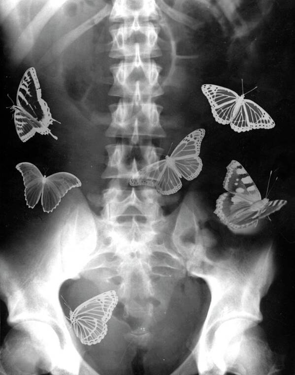 Abdomen Poster featuring the photograph Butterflies In The Stomach by Photostock-israel
