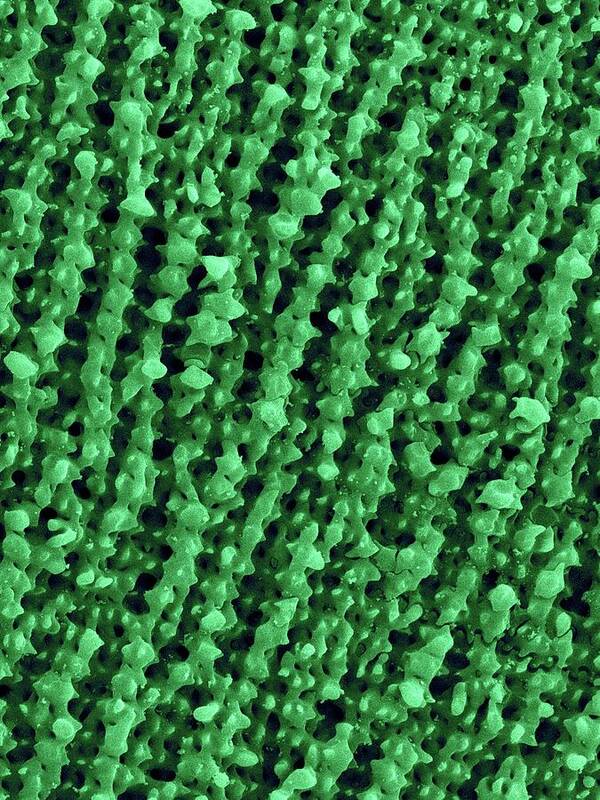 25184a Poster featuring the photograph Frog Retina Rod And Cone Cells #1 by Dennis Kunkel Microscopy/science Photo Library