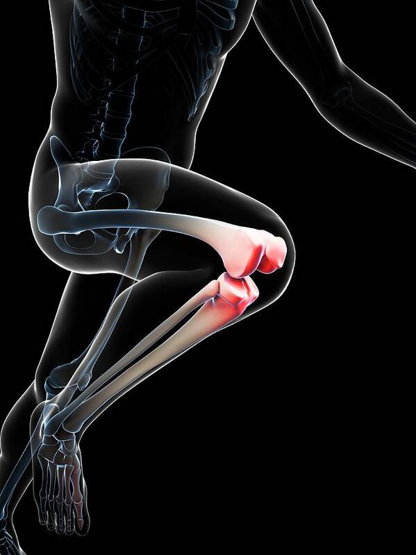 Artwork Poster featuring the photograph Runner's Knee Joint #1 by Sebastian Kaulitzki