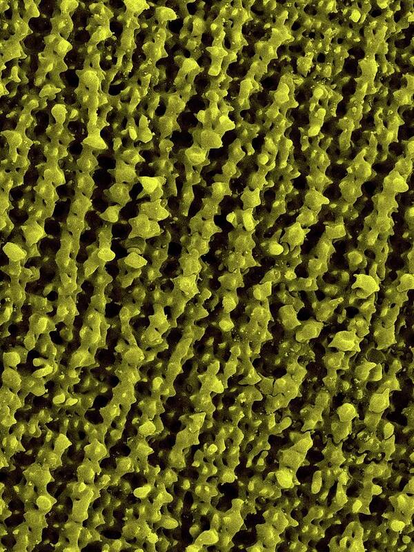 25184b Poster featuring the photograph Frog Retina Rod And Cone Cells #3 by Dennis Kunkel Microscopy/science Photo Library
