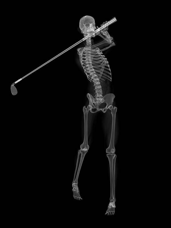 Artwork Poster featuring the photograph Skeleton Playing Golf #3 by Sciepro/science Photo Library