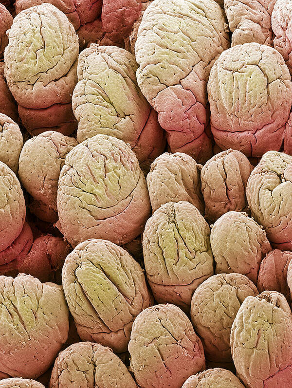 Villus Poster featuring the photograph Intestinal Lining, Sem #1 by Steve Gschmeissner