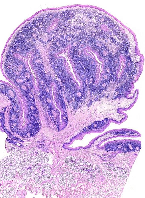 Histology Poster featuring the photograph Human Palatine Tonsil #1 by Jose Calvo / Science Photo Library