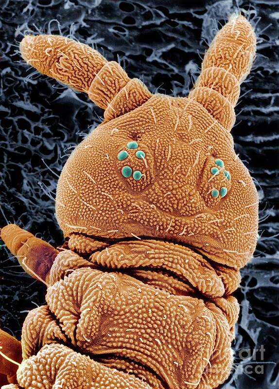 Antennae Poster featuring the photograph Sem Of A Springtail Head #1 by Dr Jeremy Burgess/science Photo Library