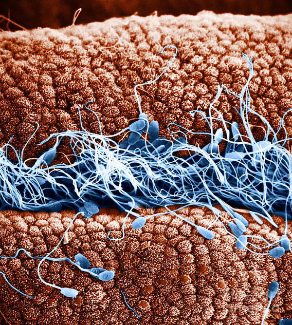Scanning Electron Micrographs Poster featuring the photograph Sperm On Oviduct Surface, Sem #2 by David M. Phillips