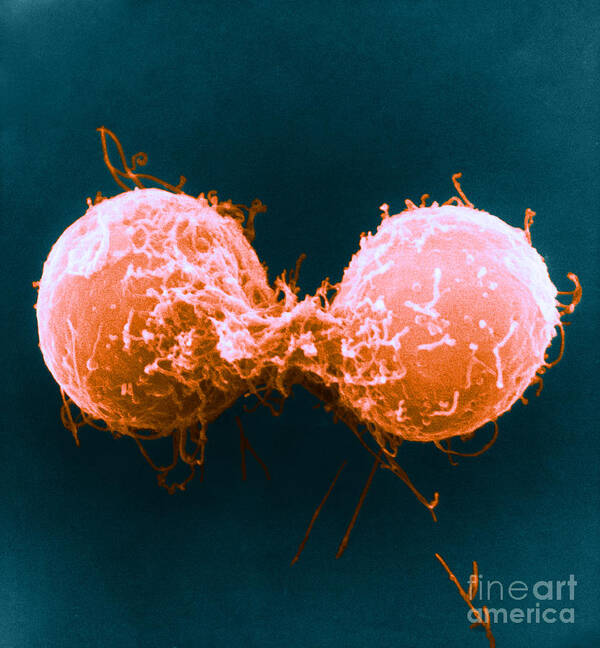 Microscopy Poster featuring the photograph Telophase, Sem by David M. Phillips