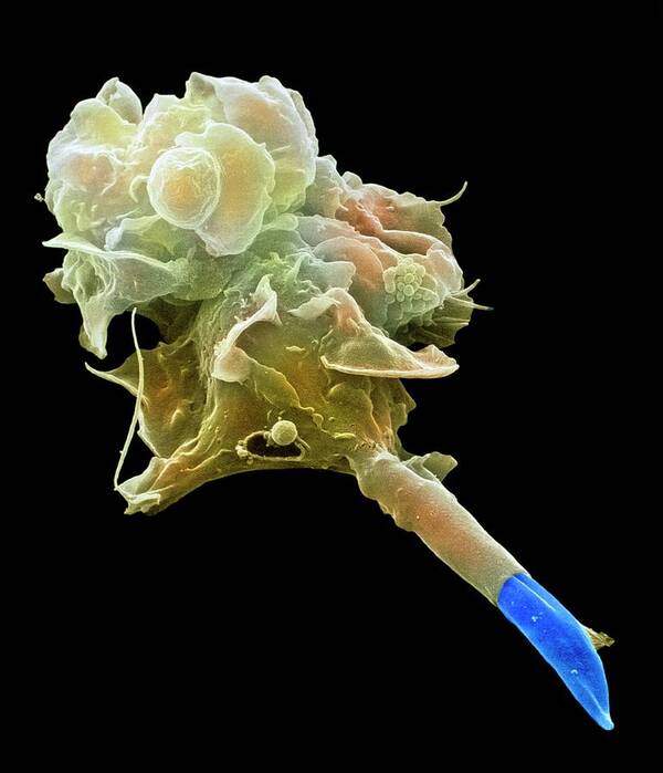 Macrophage Poster featuring the photograph Macrophage Engulfing Leishmania by Juergen Berger/science Photo Library