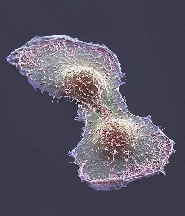 Hela Cell Poster featuring the photograph Hela Cell Division, Sem #1 by Thomas Deerinck, Ncmir