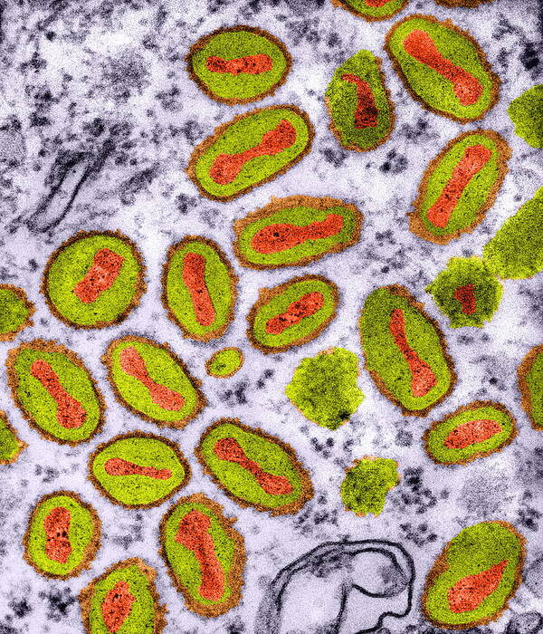 Cowpox Poster featuring the photograph Vaccinia Viruses, Tem by Dr Klaus Boller