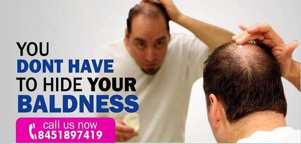 Get Cheapest Hair Transplant in Delhi Poster by Clinic Spots - Fine Art  America